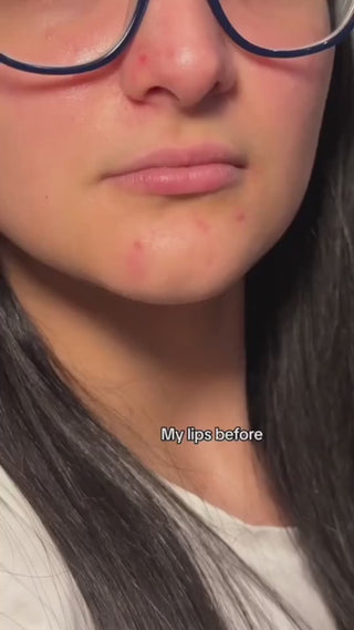 Closeup image showing a woman's lips before applying lipstick product, wearing glasses.